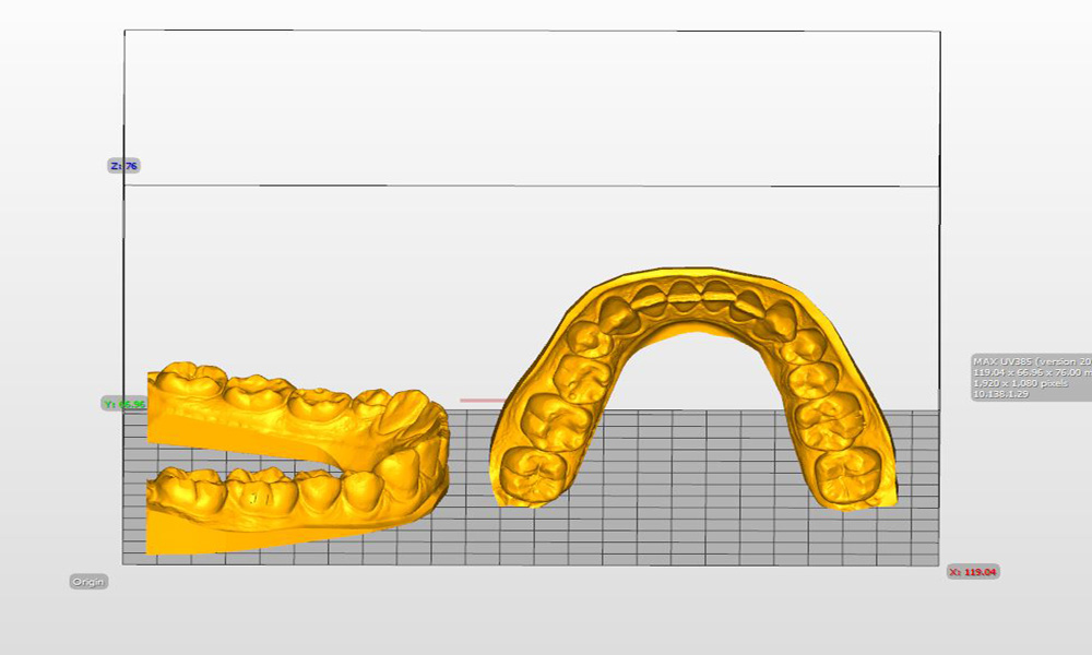 Dental-model-orientation